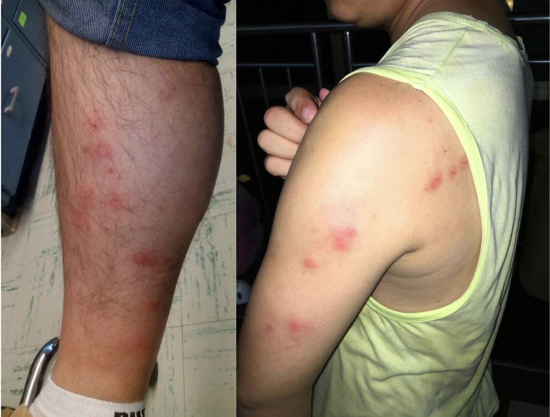 床上杀臭虫的喷什么药_怎么灭床上臭虫_怎么灭床上的臭虫